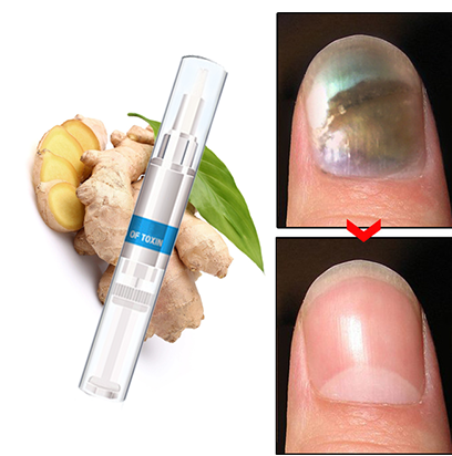 *Buy 2 Get 1 Free Advanced FungalNail Repair Pen