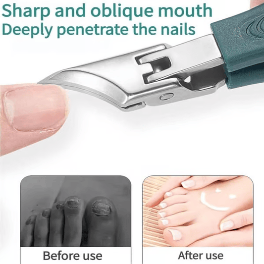 💥Buy 1 Get 1 Free🔥Eagle Beak Angled Nail Clippers 3-Piece Set